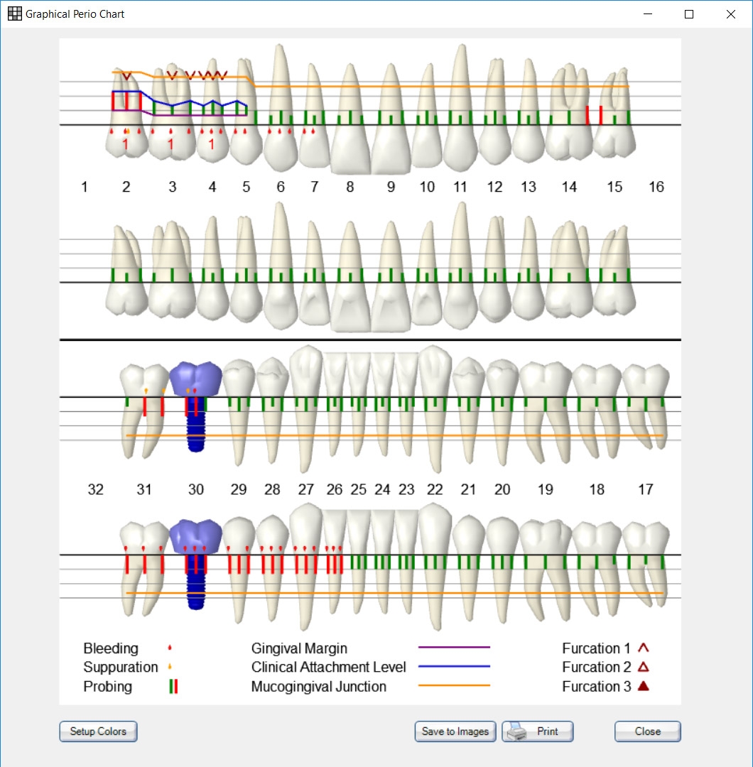 Free Printable Blank Periodontal Chart Free Printable Blank Periodontal Chart